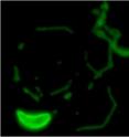 The parasite responsible for toxoplasmosis requires a stress response system that helps it survive the move to infect new cells, Indiana University School of Medicine scientists have reported, a discovery that could lead to new treatments to control the disease. The image shows two Toxoplasma parasites outside of their host cell. The trails are proteins left behind when the parasite glides on the substrate used during the imaging process.