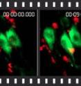 Researchers in Germany have gained new insight into how the immune system causes damage associated with multiple sclerosis, an incurable neuroinflammatory disorder. Using imaging tools which enable investigation of processes in living organisms, they were able to show a direct interaction between immune cells and neurons which plays a significant role in neuronal injury. However, this direct interaction may respond to therapeutic intervention. The study by Dr. Volker Siffrin and Professor Dr. Frauke Zipp has now been published in the journal <I>Immunity</I>.