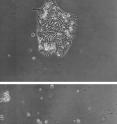 The top image shows a control colony of human embryonic stem cells at 48 hours. The bottom image shows, also at 48 hours, a colony of human embryonic stem cells treated to sidestream smoke from a harm reduction brand (the colony has been killed by the smoke treatment).