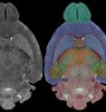 The image on the left is a conventional (optical) histology image. The middle panel is
taken from the MR images that define WHS. This "slice" from the whole intact brain
is completely without distortion. The third panel provides color labels for the
structures so clearly seen in the MR images.