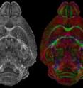 As new types of MR data become available, they can be mapped into Waxholm Space
(WHS). Shown in the first panel is an image from WHS. The second panel shows an
image from a more recent acquisition that highlights white matter. The color image
(3rd panel) shows a diffusion tensor image in which the color helps define the
direction of the white matter tracts.