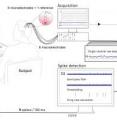 This is an illustration of the "closed-loop" from the patient viewing the image on the screen, to the acquisition system recording the activity of single neurons in his/her brain, to the system which perform the detection and filtering of spikes from the selected brain regions and the decoder which identifies the thought in the patient's brain and sends the data to the computer for visualization of the patient's thoughts.