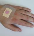 If the wound has become infected, the innovative dressing material indicates this by changing color: the yellow plaster turns purple.