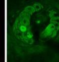 Based on characteristic vibrational spectra of endogenous molecules, many important structural components of tissue such as lipids (CH2-vibration, red), proteins (CH3-vibration, green), and water (OH-vibration, blue) can be imaged. The images show a sebaceous gland wrapping around a hair in the viable epidermis of mouse skin. (left) CH2-image in red shows the lipid-rich gland cells with sub-cellular resolution. Nuclei appear as dark circles due to the lack of lipids. (center) CH3-image in green shows residual lipid signal but also new protein-rich structures such as a hair in the center of the image, collagen fibers surrounding the gland and red blood cells in the top left. It can be seen that hair (green solid center) is surrounded by lipid-rich sebum (red circle). (right) OH-image due to water in blue shows inverse image contrast from the sebaceous gland because the lipid rich cells exclude water. Recent developments have allowed the acquisition of SRS images in reflection mode and at video-rate imaging speed in living mice and humans. Scale: 20&#956;m.