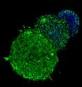 Three melanoma tumor spheroids, resistant to BRAF inhibitors, in a three-dimensional cell culture. Here, the difference between untreated living cells (green) and dead cells (blue) indicate success of a combination of MEK and PI3Ki inhibitors in killing resistant melanoma.