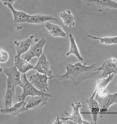 This image shows the mesenchymal cells that were treated with the negative control in the experiment.