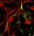 TREK1 potassium ion channels, fluorescing green in these cultured neurons, have been linked to the regulation of human emotional states.