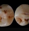 Lower premolars and canine teeth found at the Qesem cave site in Israel are raising new questions about the origins of modern man. If linked directly to Homo sapiens, it could mean that modern man either originated in what is now Israel or may have migrated from Africa far earlier that is presently accepted, says Binghamton University anthropologist Rolf Quam.