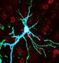 A neuron in a rat brain's cortex over-expresses PKMzeta (blue).