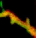 This is a close-up of a neuronal extension, revealing that PKMzeta (yellow/red) appears to be selectively recruited only to certain brain connections, where it's likely needed to help support memories.