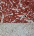 Depletion of liver HDAC3 causes fatty liver in normal adult mice. Liver tissue lacking HDAC3 (top image; fat is stained red). Liver with normal HDAC3 levels (bottom image).