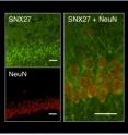 Left images show localization of SNX27 (shown in green) and NeuN (shown in red) in the CA1 region of the hippocampus, the brain’s learning and memory center. Right image shows superimposition of magnified region.