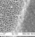 Anodizing the titanium surface of a surgical implant, left, yields a roughened surface of nanotubes, which skin cells colonize more quickly.