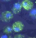 These yeast cells are expressing human FUS/TLS (green spots) in cytosol, with blue stain of nucleus.