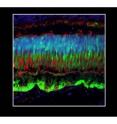 Green fluorescent protein in photoreceptors and retinal pigment epithelial cells after subretinal injection of AAV8 in a monkey retina. Cell nuclei are labeled blue and cone photoreceptors are labeled red.