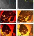 These pictures compare a piece of skin tissue imaged with the holographic microscope to the same piece of tissue imaged with a conventional microscope. The top two images (a-b) show the raw, unprocessed hologram -- the light interference pattern -- that is collected by the microscope’s sensor in reflection mode; the second image (b) is a zoomed-in version of the first (a). A computer-reconstructed image of this skin tissue is at the bottom left (c). The bottom right (d) shows a picture of the same specimen taken with a conventional, objective-lens microscope, for comparison.