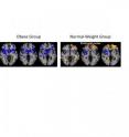 Brain reward regions are activated when glucose falls below normal levels (blue).  In lean people -- but not obese people -- the prefrontal cortex which is involved in decision making and regulating impulses is activated (red) when glucose levels are normal.