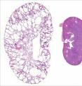 A polycystic mouse kidney (left) is several times larger than a normal mouse kidney (right). The tissue architecture of the diseased kidney is destroyed by the growth of numerous cysts.