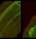 This is a close-up view of a normal mouse cochlea (left) and one missing FGF20 (right), showing gaps in sensory hair cells.