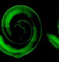 These are images of mouse cochlea, the part of the inner ear responsible for turning mechanical vibrations of sound waves into electrical signals that are sent to the brain. The normal mouse cochlea (left) has continuous rows of sensory hair cells. The cochlea of mice missing FGF20 (right) have gaps in the rows of hair cells. This abnormal structure results in profound deafness.