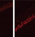 In a mouse model of Alzheimer's disease (right), HDAC2 levels in the hippocampus are higher than in the normal mouse hippocampus (left).