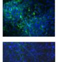 This image shows immunostaining of wild-type (top) and H1 triple-knockout (bottom) cultures under a neural differentiation protocol. The H1 triple-knockout cells were defective in forming neuronal and glial cells and a neural network, which is essential for nervous system development.