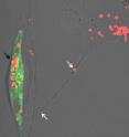 Two nerve cells, each about 10 micrometers large, are visible as shadows in this picture. From the beginning only the right one (yellow arrow) contained the toxic, red stained, oligomeric beta-amyloid. When these sick cells make contacts with the healthy, green labeled cells (black arrow), toxic beta-amyloid will spread through the neuronal projections (white arrow). Subsequently, also the green cell will become sick.