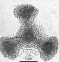 <i>Dictyocoryne truncatum</i>, normally found near the equator, was one of nearly 100 species of protozoa found living in the arctic ocean in 2010.