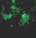 These are cardiomyocytes (heart muscle cells) generated from stem cells and expressing a green fluorescent protein.