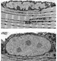 UI researchers have identified a key protein involved in muscle atrophy. The protein, Gadd45a, reprograms hundreds of genes inside a muscle cell's nucleus, causing the nucleus to dramatically change from a cigar shape (top) to a swollen bulb (bottom).