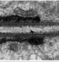 This is an electron microscopy picture of a section through the flagellum of a <i>Drosophila melanogaster</i> sperm cell. The base of the flagellum is on the left, and the falgellum's skeleton extends from left to right. The black arrowhead points to the first chain of the central microtubule pair, without which the flagellum cannot move in a coordinated fashion.