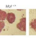 Mouse stem cells with two normally functioning copies of the Mof gene (left) have intact "stem-ness" -- but that ability to self-renew is lost in cells in which one or both copies of Mof don't work correctly (middle and right).