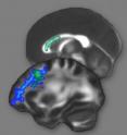 The brain’s white matter, shown above, contains the connections between neurons. The white matter regions highlighted in green or blue showed changes after intense preparation for the LSAT, suggesting improved interconnections among reasoning areas of the brain.