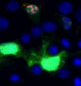 These FXTAS model cells show the defects, in orange, that cause tremor ataxia syndrome.