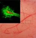 Real-time imaging of a rodent brain shows that nanoparticles coated with polyethylene-glycol (PEG) (green) penetrate farther within the brain than particles without the PEG coating (red).