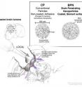 During surgery to excise a brain tumor, direct access to the brain and the space in between its cells is possible. Conventional nanoparticles carrying chemotherapeutic drugs can be applied during the surgery, but they essentially remain on the surface where they are applied (red arrows). Nanoparticles coated with a sufficient amount of PEG have the capacity to diffuse through the tissue (purple arrows) so that they can migrate towards the individual tumor cells that have escaped from the tumor mass.