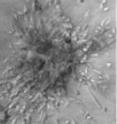 Two pieces of the same human metastatic breast tumor acted very differently depending on their protein environments. Breast tumor cells in a tumorous environment (left) rapidly exited the tumor fragment. Breast tumor cells in a healthy environment (right) grew in a controlled manner.