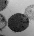 This is a transmission electron microscopy image of a <i>Streptococcus pyogenes</i> cell experiencing lysis after exposure to the highly active enzyme PlyC.