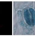 This is the expression of the ZIFL1 gene in the root (green fluorescence, left panel) and in the stomata of leaves (blue staining, right panel).