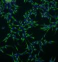 These neural stem cells, derived from people with bipolar disorder by scientists at the University of Michigan, will aid further discoveries about bipolar disorder genetics