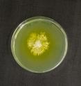 This is the mold fungus <i>Trichoderma</i>.