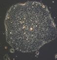 This is a 100X magnification of a human embryonic stem cell colony.