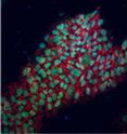 For the first time, the Belmonte laboratory has replaced OCT4, one gene previously thought indispensable for the reprogramming of human cells into embryonic-like cells.

The picture shows newly reprogrammed cells expressing marks of pluripotency as identified by fluorescence (NANOG in green, TRA-1-81 in red).