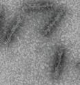 Using electron microscopy, researchers observed IFI16 pathogen sensors lining up along pieces of DNA.