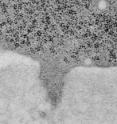 This electron micrograph shows a cancer cell (upper darker area) that has formed three invadopodia that are penetrating the adjacent extracellular matrix (lower lighter area).