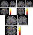 Researchers from Princeton University and the Free University of Berlin found that taste-related metaphors such as 'sweet' actually engage the emotional centers of the brain more than literal words such as 'kind' that have the same meaning. Sentences containing words that invoked taste activated areas in the lateral orbitofrontal cortex (a) and frontal operculum (b) known as the gustatory cortices that allow for the physical act of tasting. Taste-related metaphors also stimulated brain regions known to be associated with emotional processing, such as the left hippocampus, parahippocampal gyrun and amygdala (c). The colors indicate the level of activation prompted by metaphorical sentences in comparison to literal sentences with 8 signifying the greatest amount of neural activity.