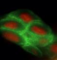 This is an image depicting the palisades of Vogt within the human limbus. The human limbal architecture shows the palisades of Vogt in whole mounted tissue labeled with collagen VII and imaged with a laser scanning confocal microscope. Image is a stitched Z stack series.