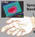 The transparent liquid bandage displays a quantitative, oxygenation-sensitive colormap that can be easily acquired using a simple camera or smartphone.