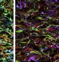 Compared with a control skin wound (left), the ECM within a wound containing increased numbers of myofibroblasts (right) is more consistently organized into linear fibers, which increases the activation and release of a growth factor that promotes fibrosis.