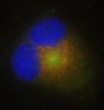 New fluorescent dyes help illuminate lysosome structures.